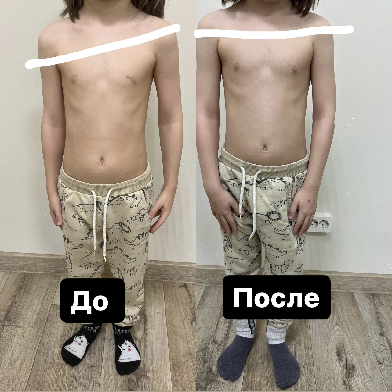 Пример До/После 1