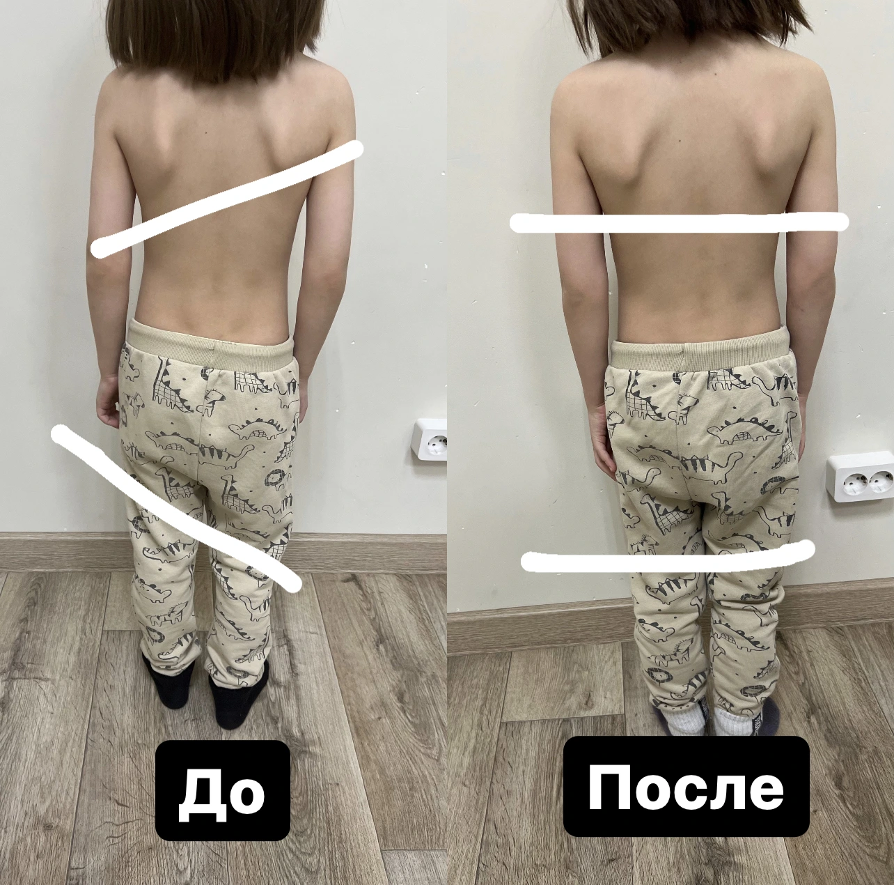 Пример До/После 2