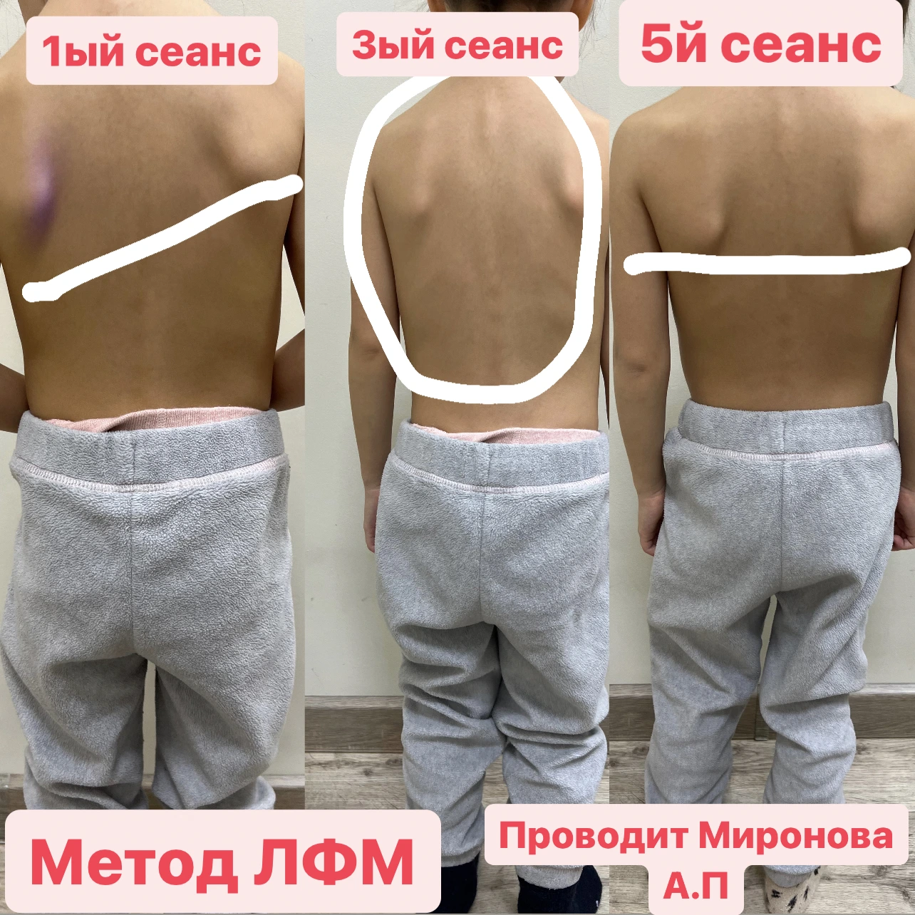 Пример До/После 3