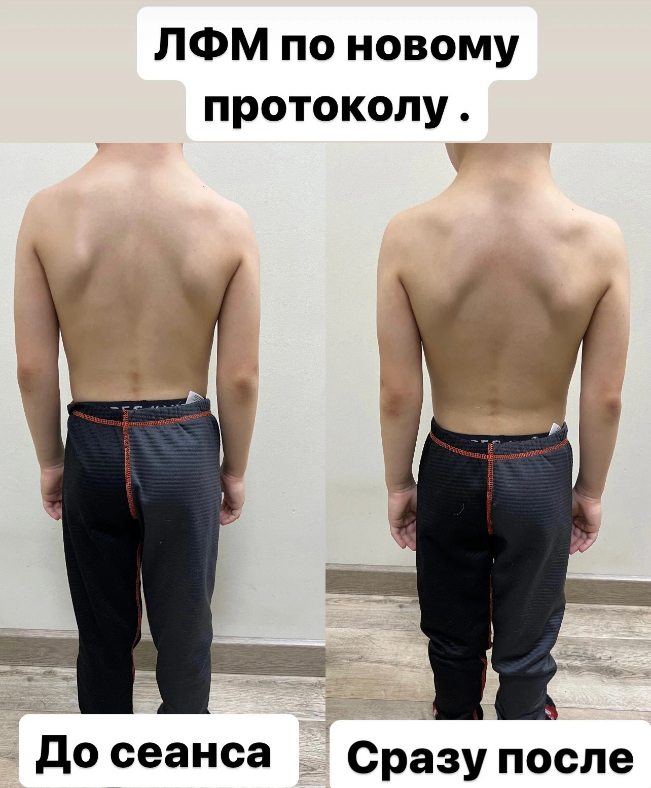 Пример До/После 4