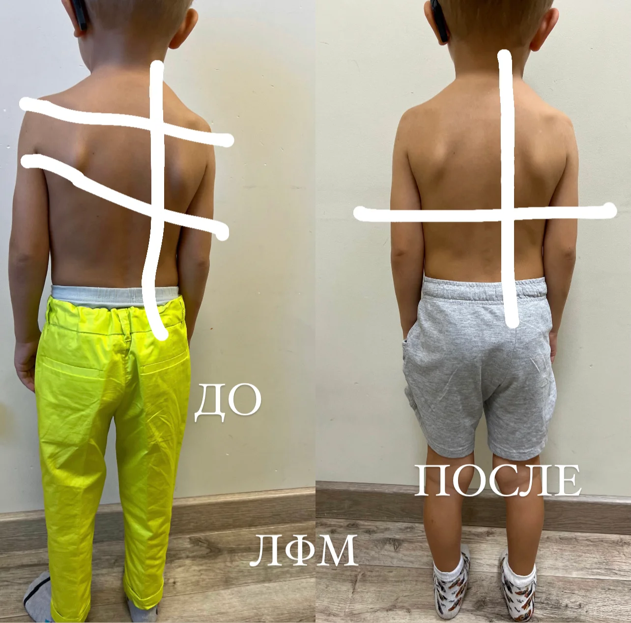 Пример До/После 6