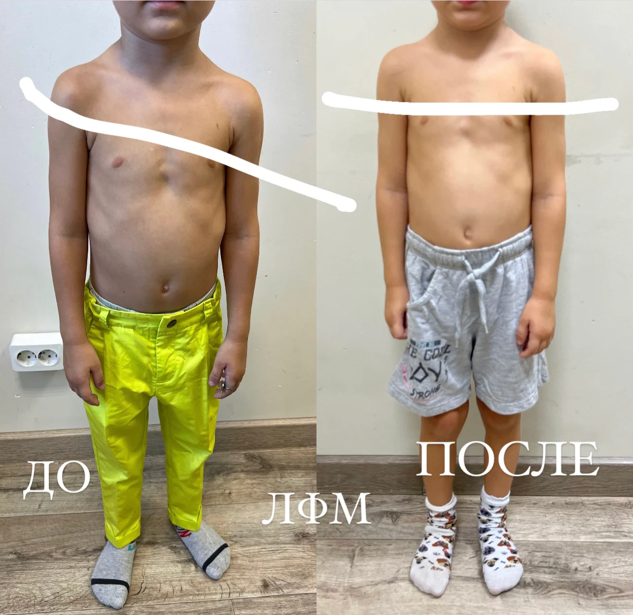 Пример До/После 7