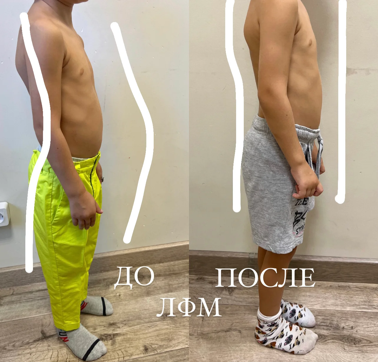 Пример До/После 8