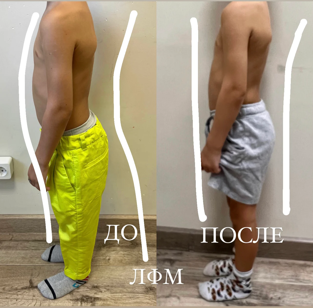 Пример До/После 9