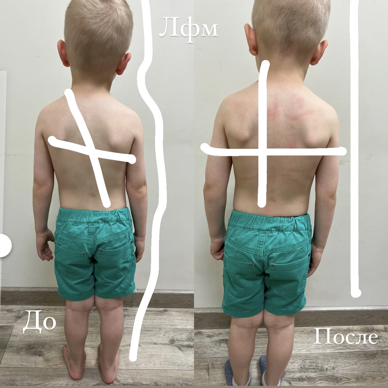 Пример До/После 5